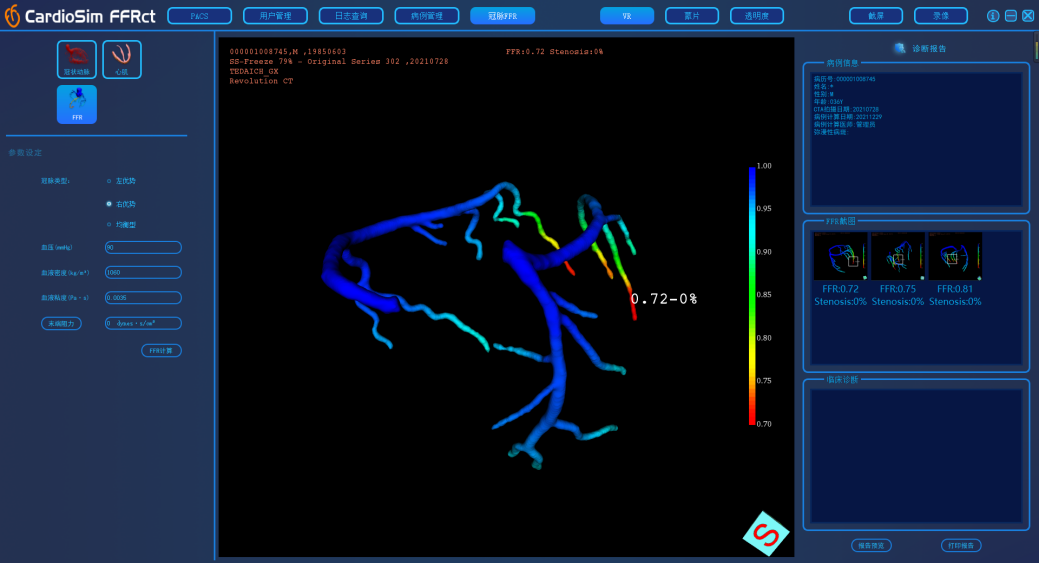 36氪首发 | 将生物流体力学技术在心血管领域做临床转化，「晟视科技」获近亿元Pre-A轮融资